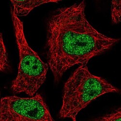 ZNF574 Antibody, Novus Biologicals 25 &mu;L, Unlabeled:Antibodies, Polyclonal